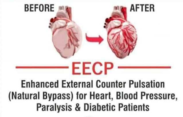EECP therapy