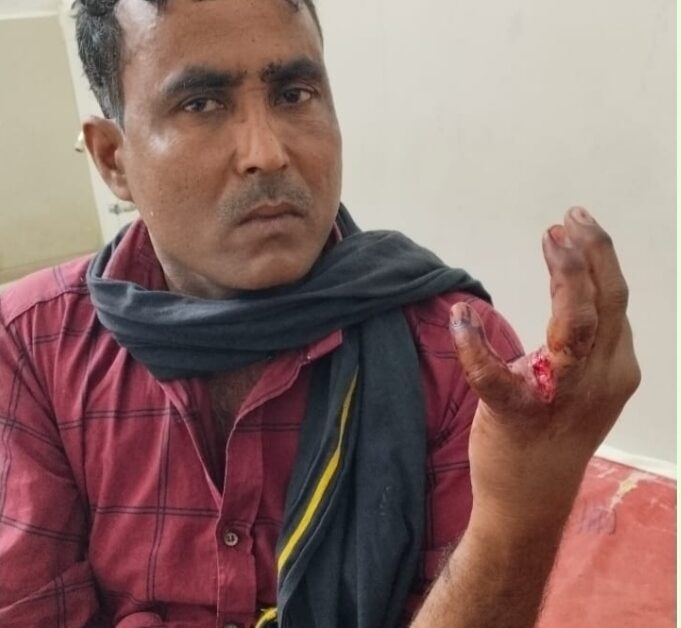 आपसी रंजीत में हुई मारपीट, एक घायल 1 fight between rivals